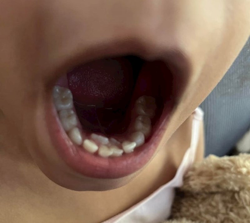 1. "Mojem sinu rastu dodatni zubi"