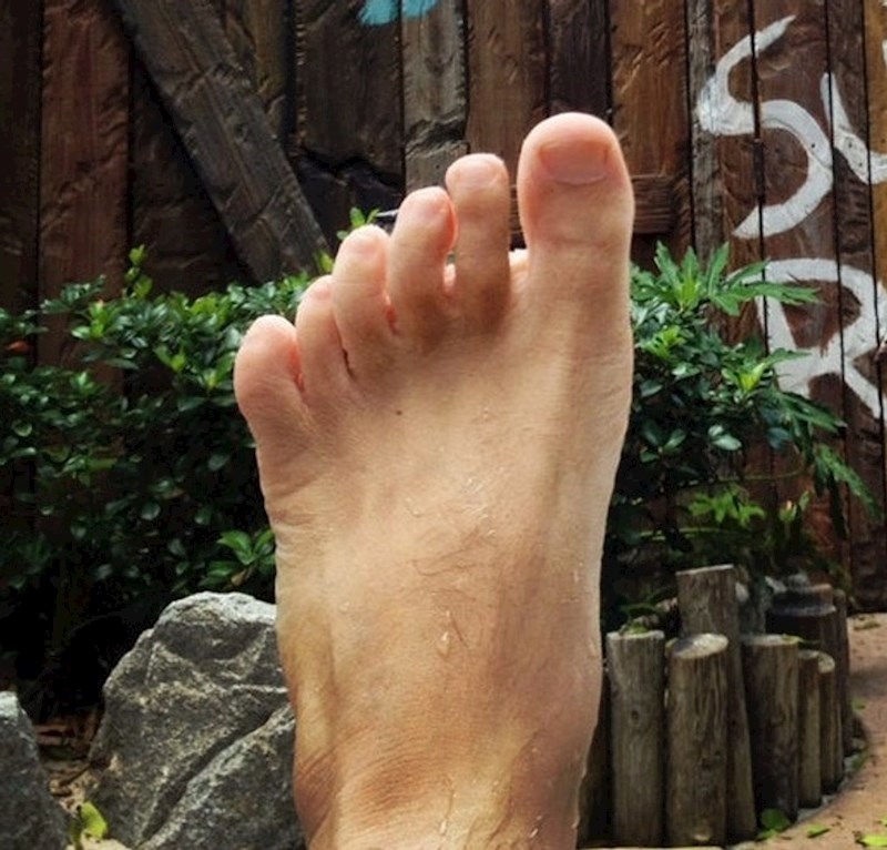 8. "Na jednom stopalu pet, a na drugom šest prstiju"