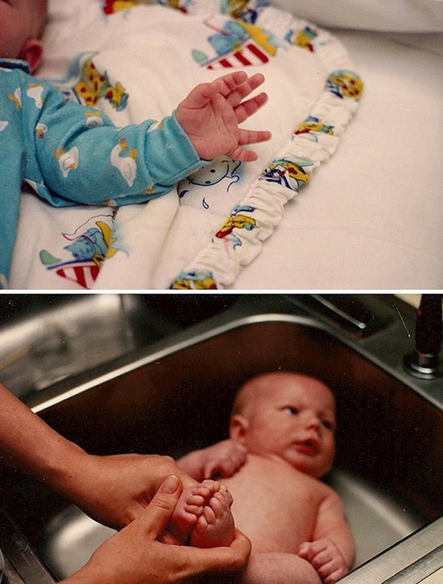 "Rođena sam sa šest prstiju na rukama i nogama. Ovo su moje fotke dok sam bila beba."