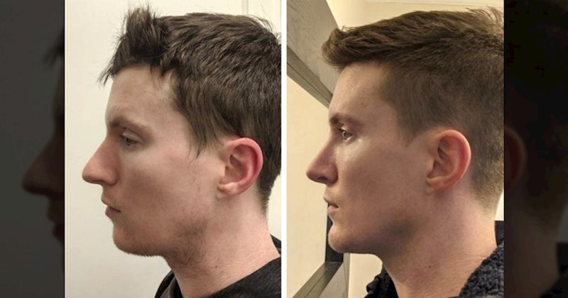 Ovih 16 ljudi odlučilo je drastično promijeniti izgled. Pogledajte fotke prije i poslije zahvata