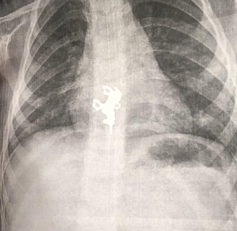 6. Jedan izlet u bolnicu