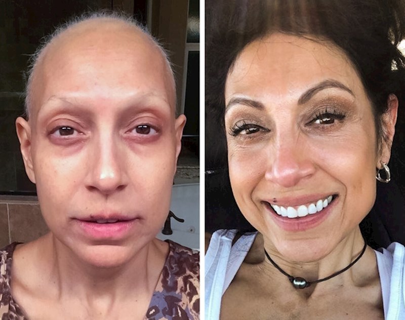 7. "Ovo sam ja dok sam bila bolesna i nakon. Mislim da je promjena vidljiva, u svakom mogućem smislu"