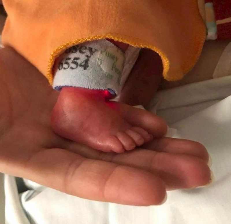 3. "Na ovoj slici izgleda kao da moj mališan ima ogroman palac"