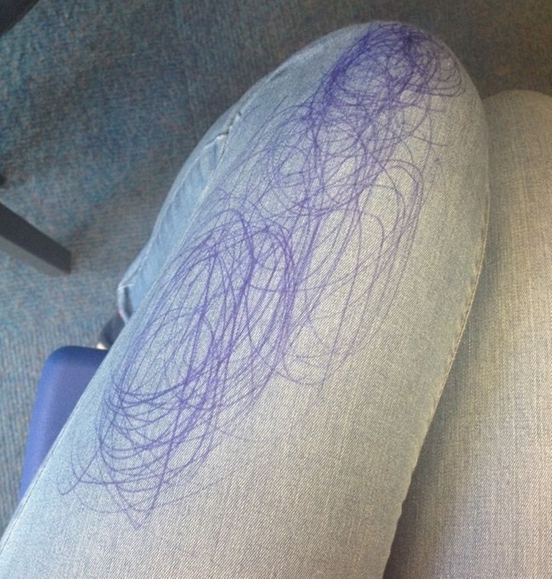 6. "Mislila sam da je kemijska zatvorena, a onda sam pogledala nogu..."