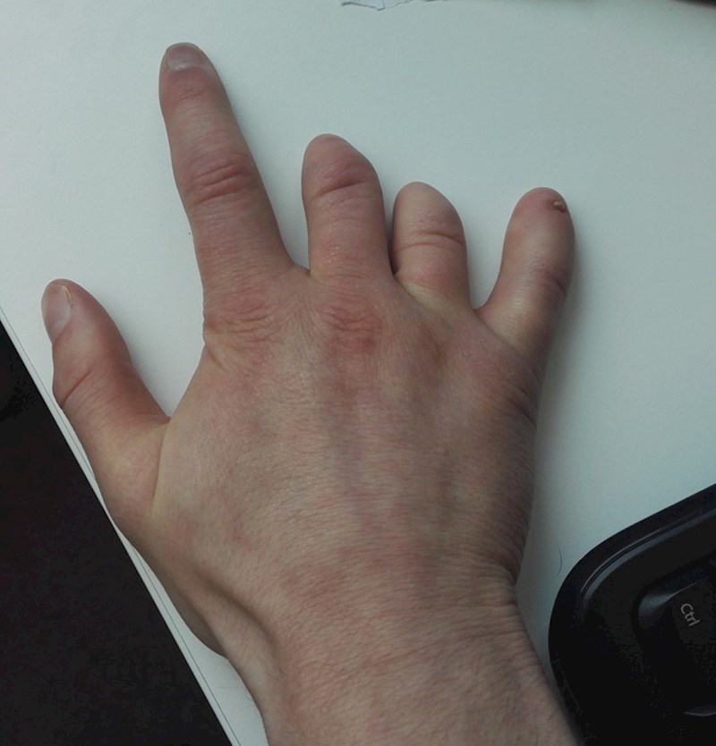 6. "Moja mala deformacija, ali mi uopće ne predstavlja problem"