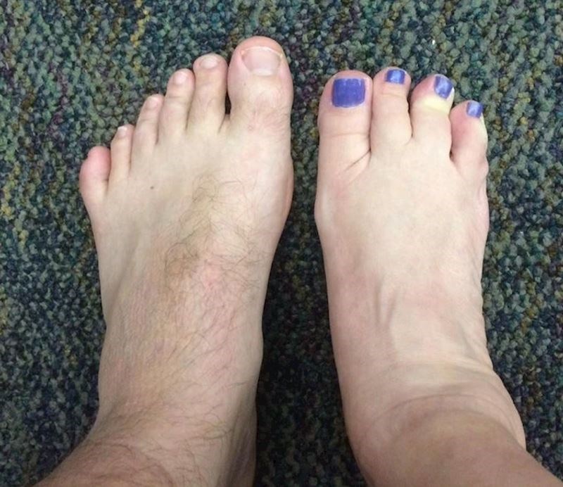 5. "Na jednom stopalu četiri, a na drugom šest prstiju"