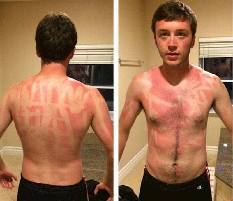 4. "Moj prijatelj je mislio da će mu biti dovoljna zaštita ako se namaže kremom za sunčanje u sticku. E pa..."