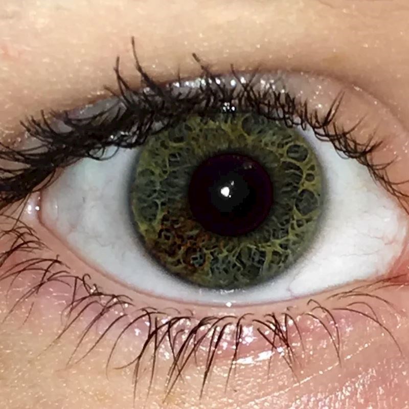 "Imam baš neobičan uzorak u oku, kao da ga je netko crtao"