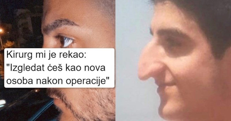 14 ljudi kojima je estetski zahvat potpuno promijenio izgled i život