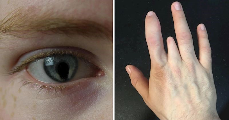 10+ ljudi koji se zahvaljujući svojim fizičkim karakteristikama ističu u gomili, pogledajte primjere