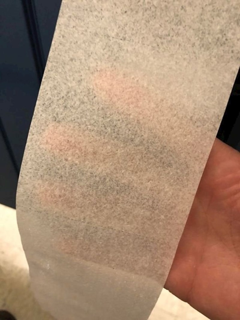 "Moj škrti prijatelj ima najgori WC papir ikad."