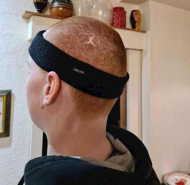 "Ožiljak mojeg brata izgleda kao logo Air Jordanica."