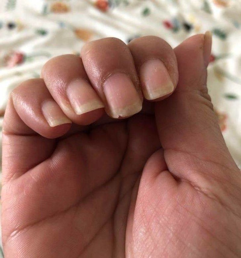 4. Ono kad vam se bez nekog očitog razloga ovako okrhne nokat i počne zapinjati za sve i svašta...😫