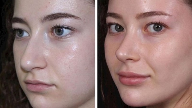 17 žena kojima je estetska kirurgija pomogla da vrate svoje samopouzdanje