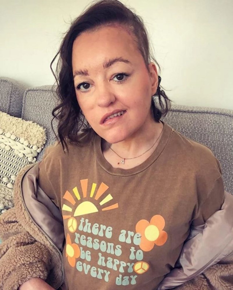 9. Prošla je kroz izrazito kompliciranu neurološku operaciju i podijelila fotku svojeg oporavka💪🏼