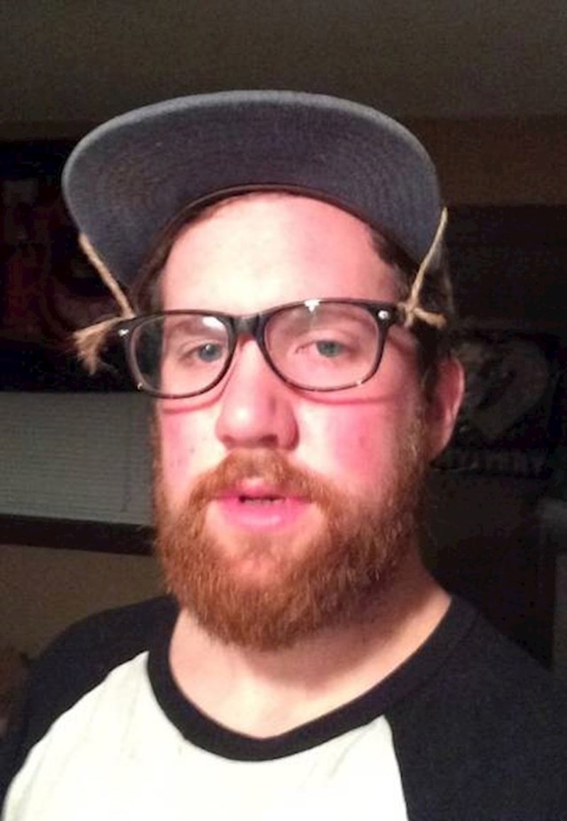 5. Operirao sam nos i nisam smio nositi naočale koje ga dodiruju. Evo kako sam se snašao.