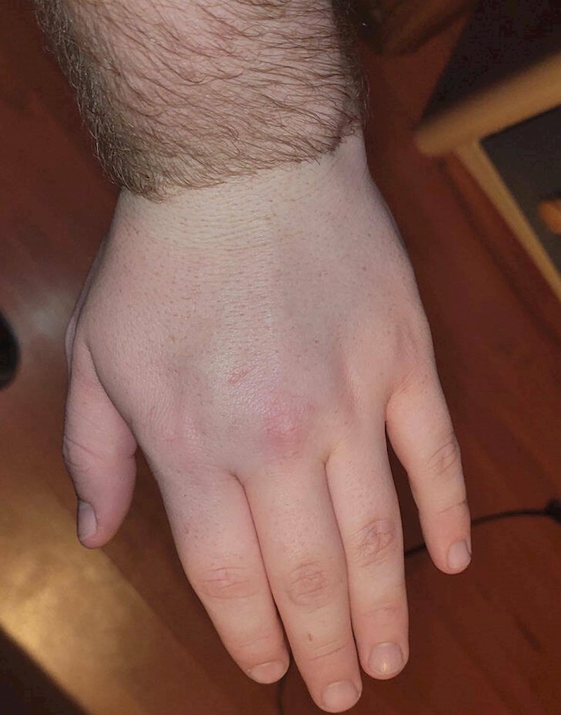 19. Obrijao je svoju dlakavi dlan i sada izgleda još smješnije