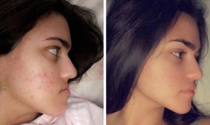20 ljudi kojima su estetski zahvati pomogli steći samopouzdanje i zadovoljstvo