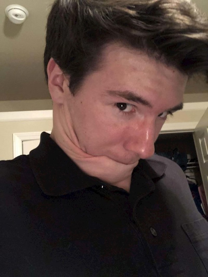 "Imam tako elastičnu kožu na vratu da ju mogu staviti u usta."