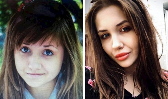 20+ djevojaka pokazale su kako im se fizički izgled s godinama promijenio, neke su neprepoznatljive