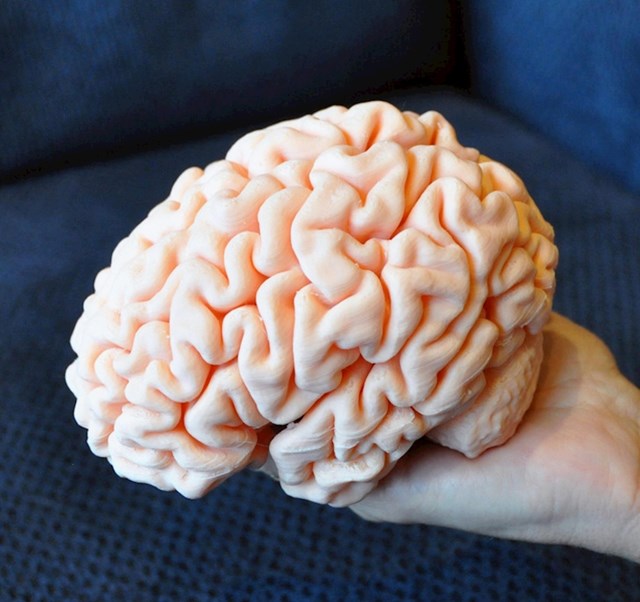 10. Napravio sam model mozga svoga sina u 3D printeru