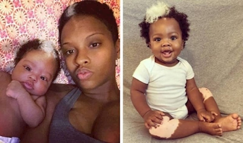 6. Majka i kćer dijele istu genetsku mutaciju