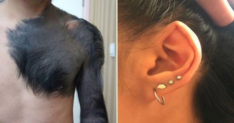 30+ ljudi s čijim se fizičkim karakteristikama poigrala genetika