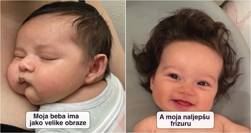 15 beba s unikatnim fizičkim osobinama zbog kojih plijene pažnju gdje god se pojave