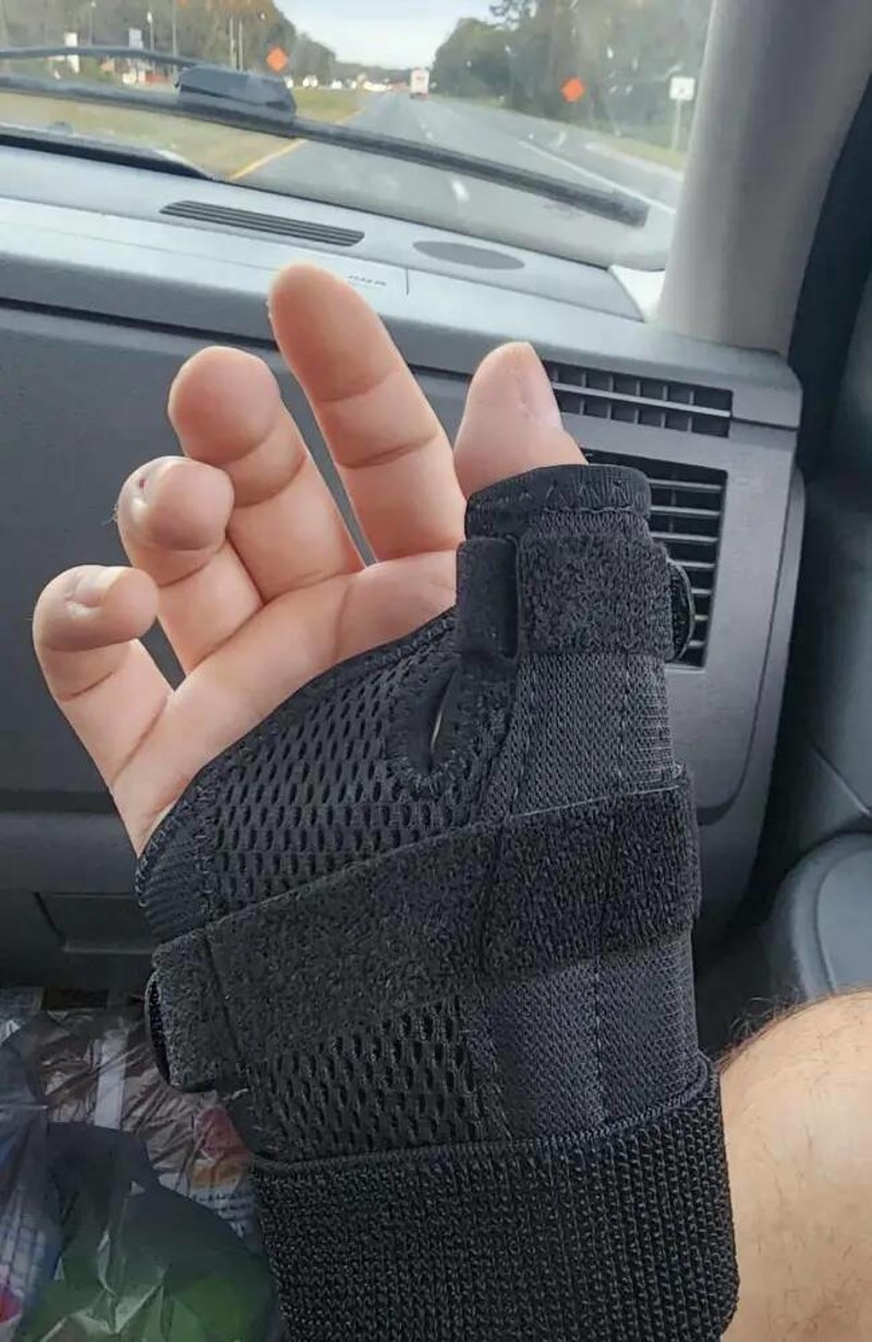 5. Slomio je prst dok je obuvao čarapu