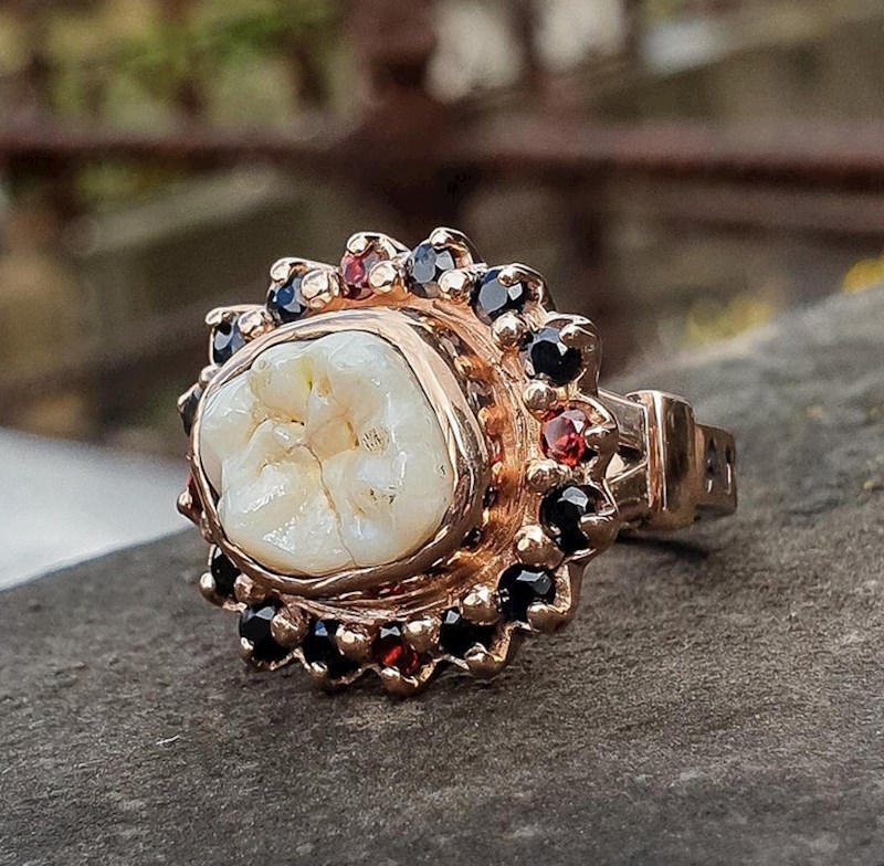 15. Jedan mladoženja je u vjenčani prsten ugradio svoj kutnjak 🤣