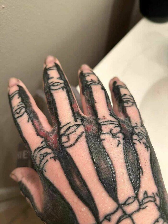 11.