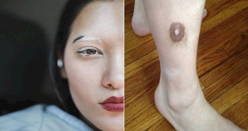 12 ljudi koji su postali popularani zahvaljujući genetskim mutacijama