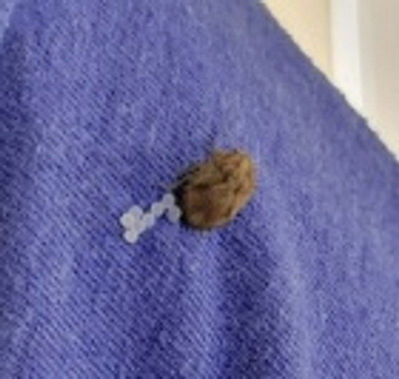 16. Kukac je sletio na mene i položio jaja