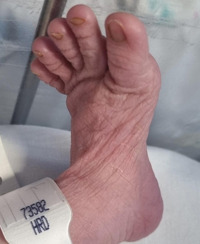 1. Moja beba ima stopala poput hobita