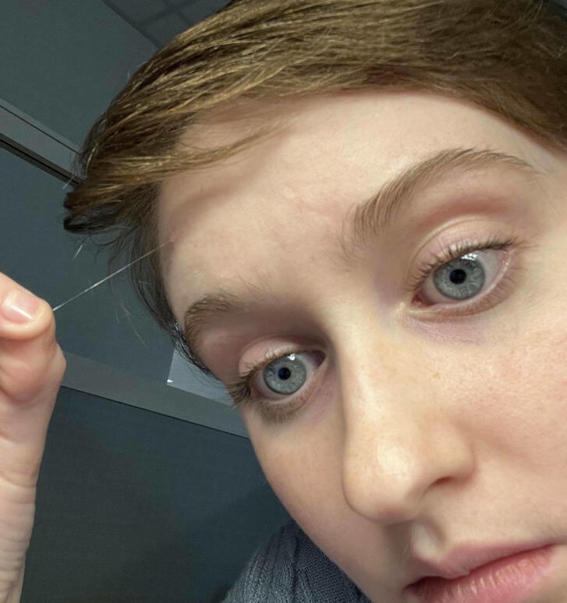 2. Ekstremno dugačka bijela dlaka koja raste iz mojeg čela