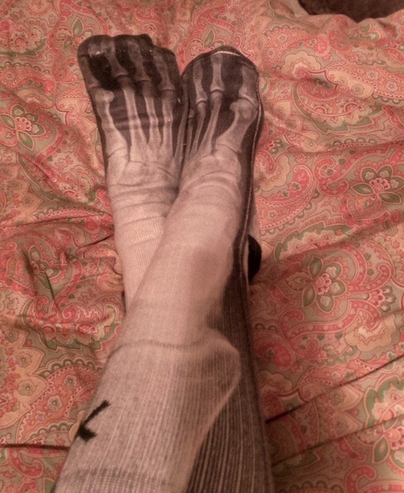 14. Studiram radiologiju i dobila sam najbolji poklon za ročkas