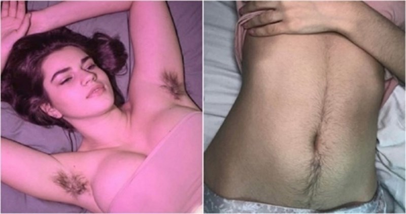 Ovih 17 žena rekle su zbogom britvicama i prihvatile svoje dlačice, njihove fotke obišle su svijet