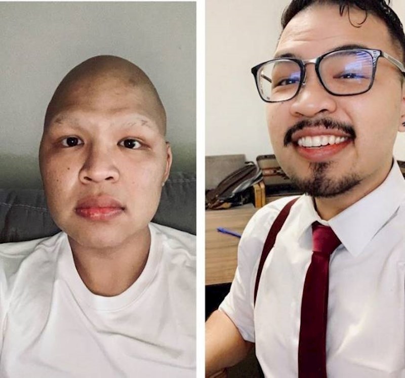 4. Pobijedio je težak oblik metastatskog karcinoma! 👏🏼