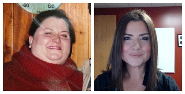 14. Žena je skinula 85 kilograma i izgleda fenomenalno! Svaka čast!