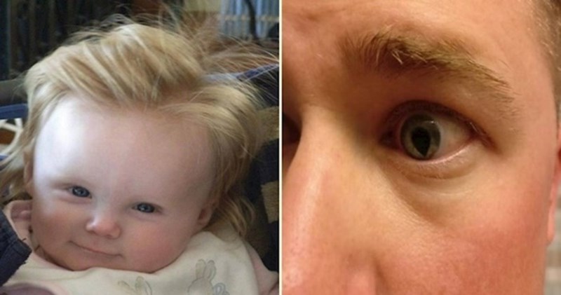 18 ljudi kojima je priroda podarila nevjerojatne fizičke osobine