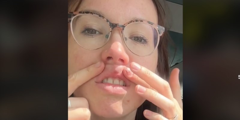 Žena je zalijepila usne i rekla mužu da je bila na korekciji, snimka njegove reakcije je urnebesna