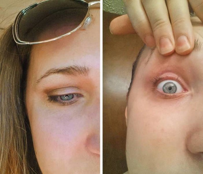 2. Kihnula sam dok sam uvijala trepavice