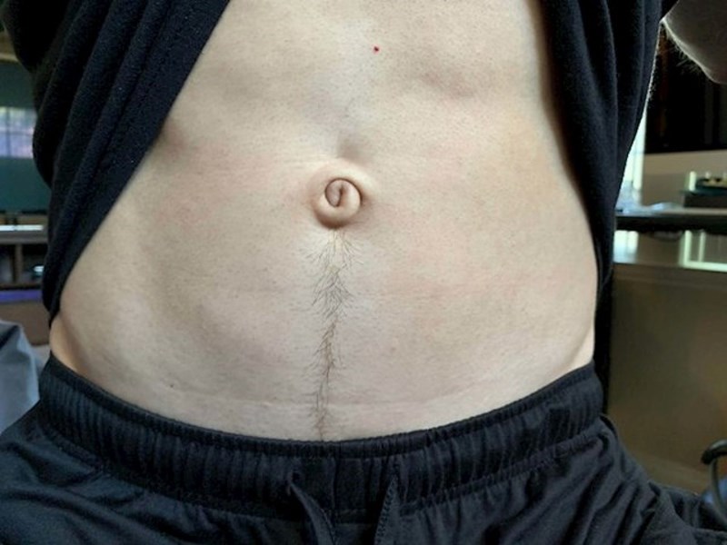 Ovakav pupak se rijetko viđa.