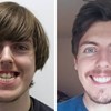 17 ljudi koji su se potpuno transformirali nakon što su popravili zube