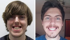 17 ljudi koji su se potpuno transformirali nakon što su popravili zube