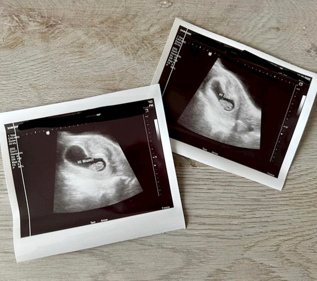 8. Ultrazvuk naše bebe koja se prvi put pomaknula