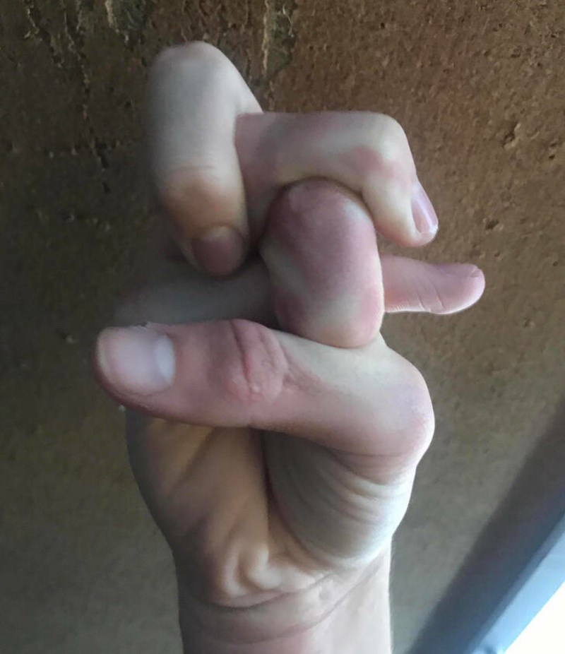 Imam jako elastične ruke