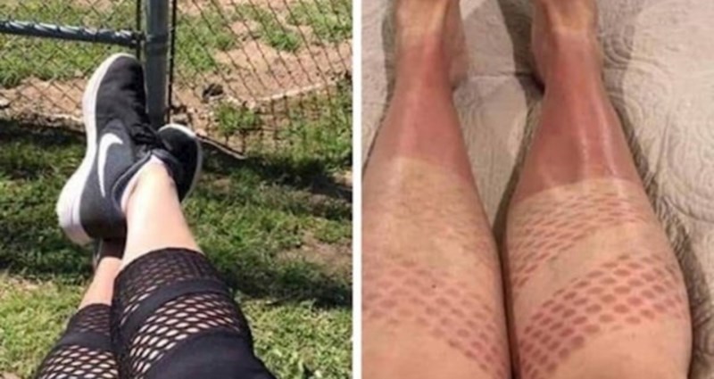 12 iritantnih problema s kojima se tu i tamo susretne baš svaka žena