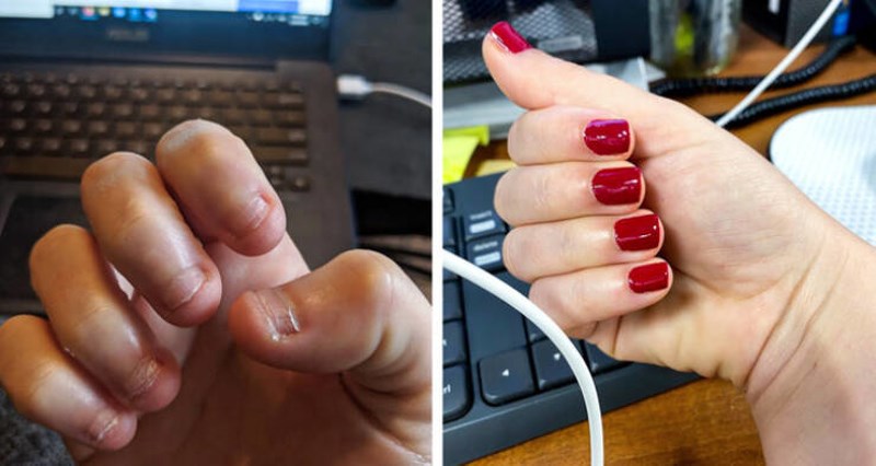 2. Prestala sam gristi nokte