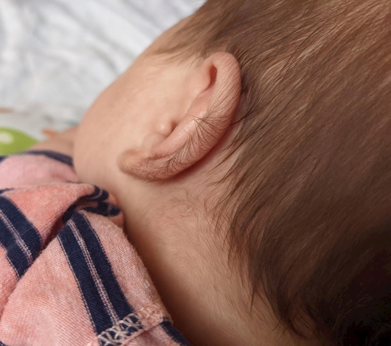 2. Moj sin rodio se s dlakavim ušima